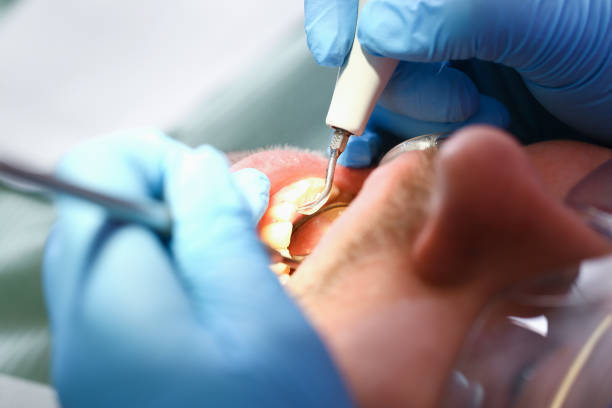 Best Weekend Emergency Dentist in Blue Rapids, KS