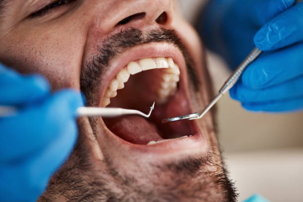 Best Weekend Emergency Dentist in Blue Rapids, KS
