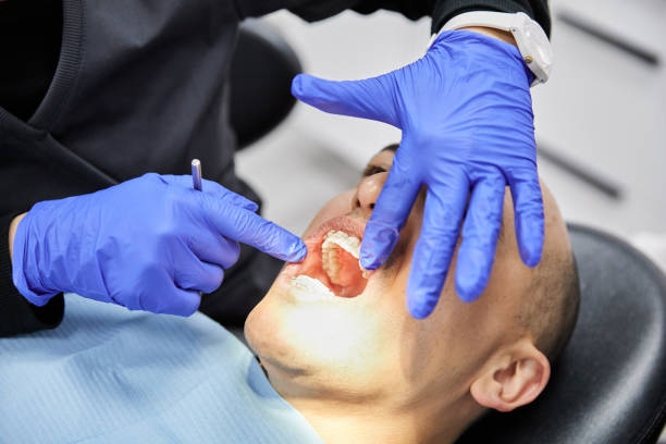 Best Emergency Dental Extractions in Blue Rapids, KS